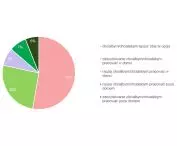 Respondents' preferences for post-pandemic COVID work model -19