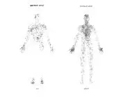 Emotion atlas, happiness and anger; illustration based on Prof. Lauri Nummenmaa's emotion maps