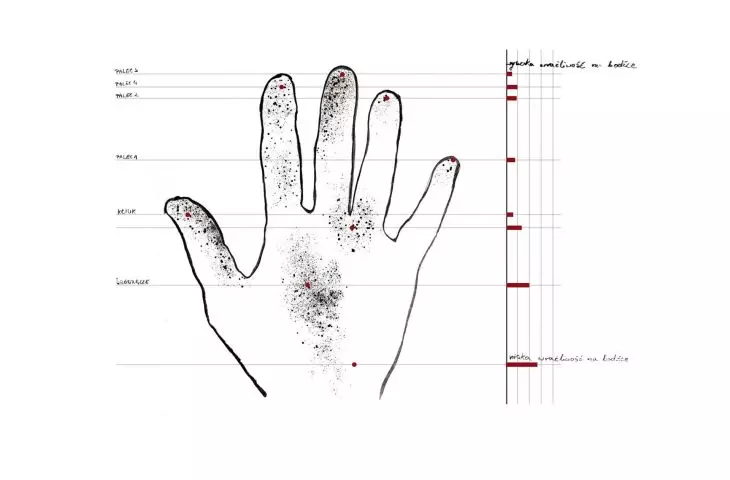 Map of superficial sensation of the hand; illustration based on anatomical diagrams