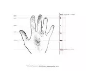 mapa czucia powierzchownego dłoni; ilustracja na podstawie schematów anatomicznych