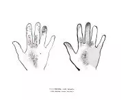 Receptors of the hand; illustration based on anatomical diagrams