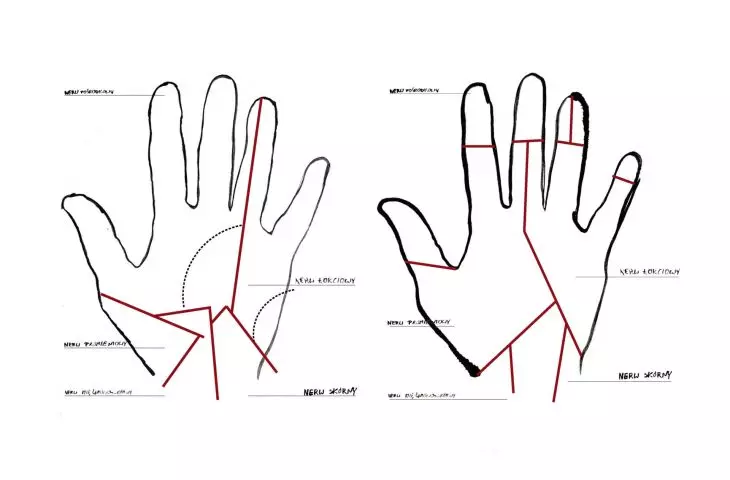 innervation of the hand; illustration based on anatomical diagrams