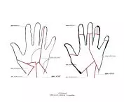 innervation of the hand; illustration based on anatomical diagrams